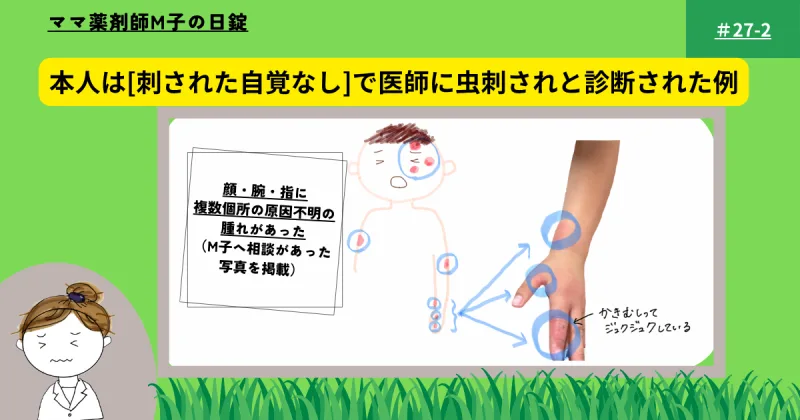 虫刺されの処方例を示す画像